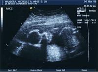 Ultrasounds