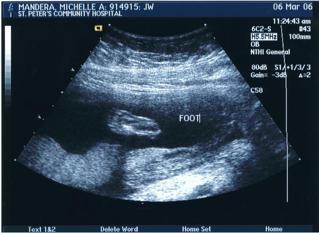 foot.jpg