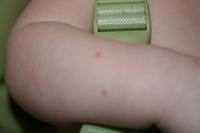 First cat bite