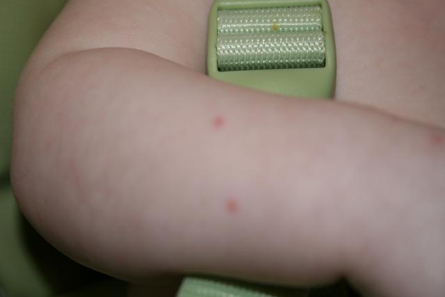 First cat bite
