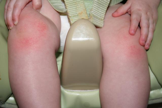 Ouch!  Crawling is hard on the knees..