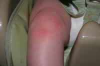 Ouch!  Crawling is hard on the knees..