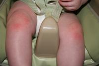 Ouch!  Crawling is hard on the knees..